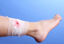 રાજુલાના મોભીયાણા ગામે વરઘોડા દરમિયાન અથડામણ ઃ એક યુવકને ગંભીર ઈજા